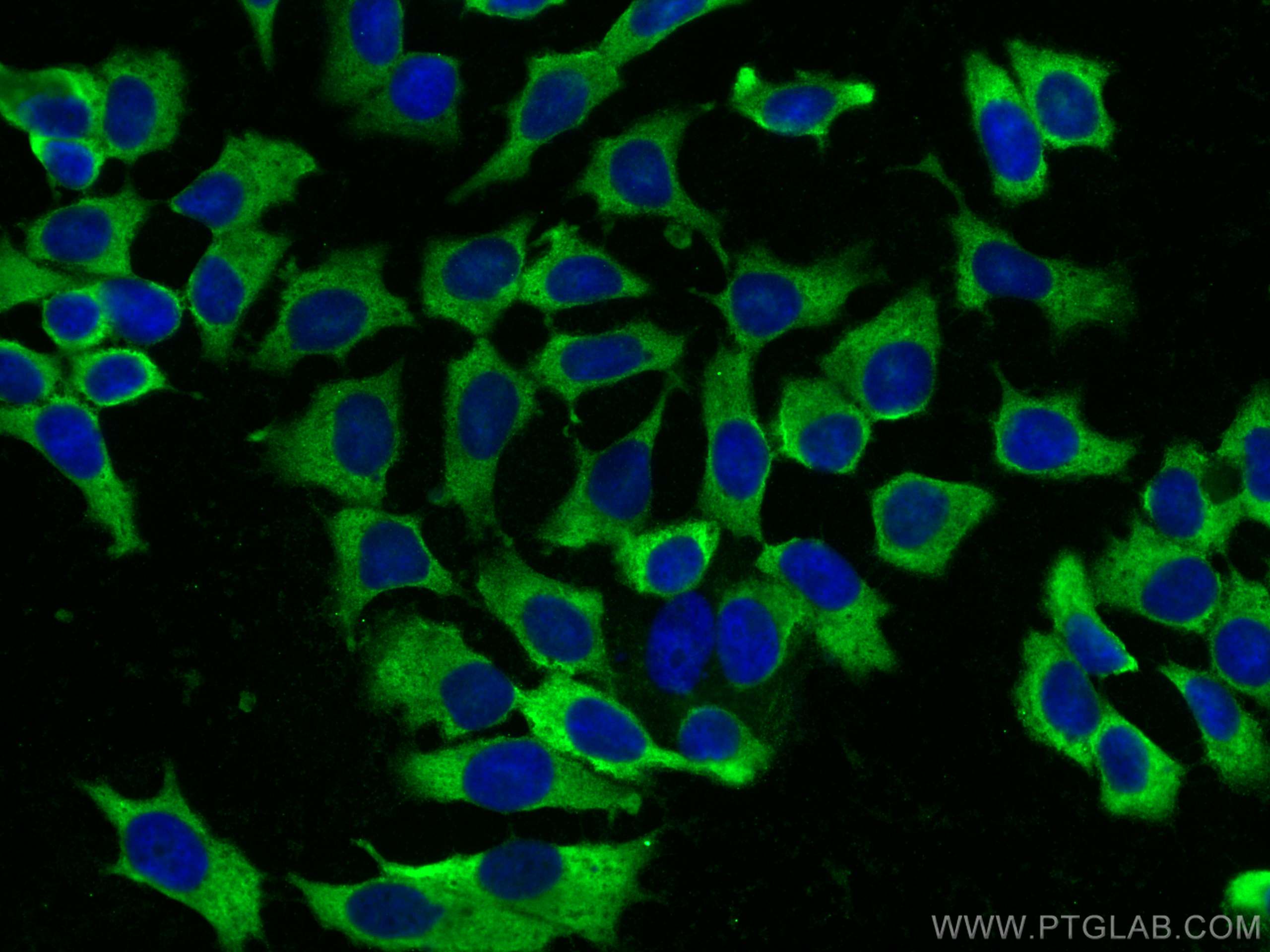 Immunofluorescence (IF) / fluorescent staining of MCF-7 cells using FBP1 Monoclonal antibody (68446-1-Ig)