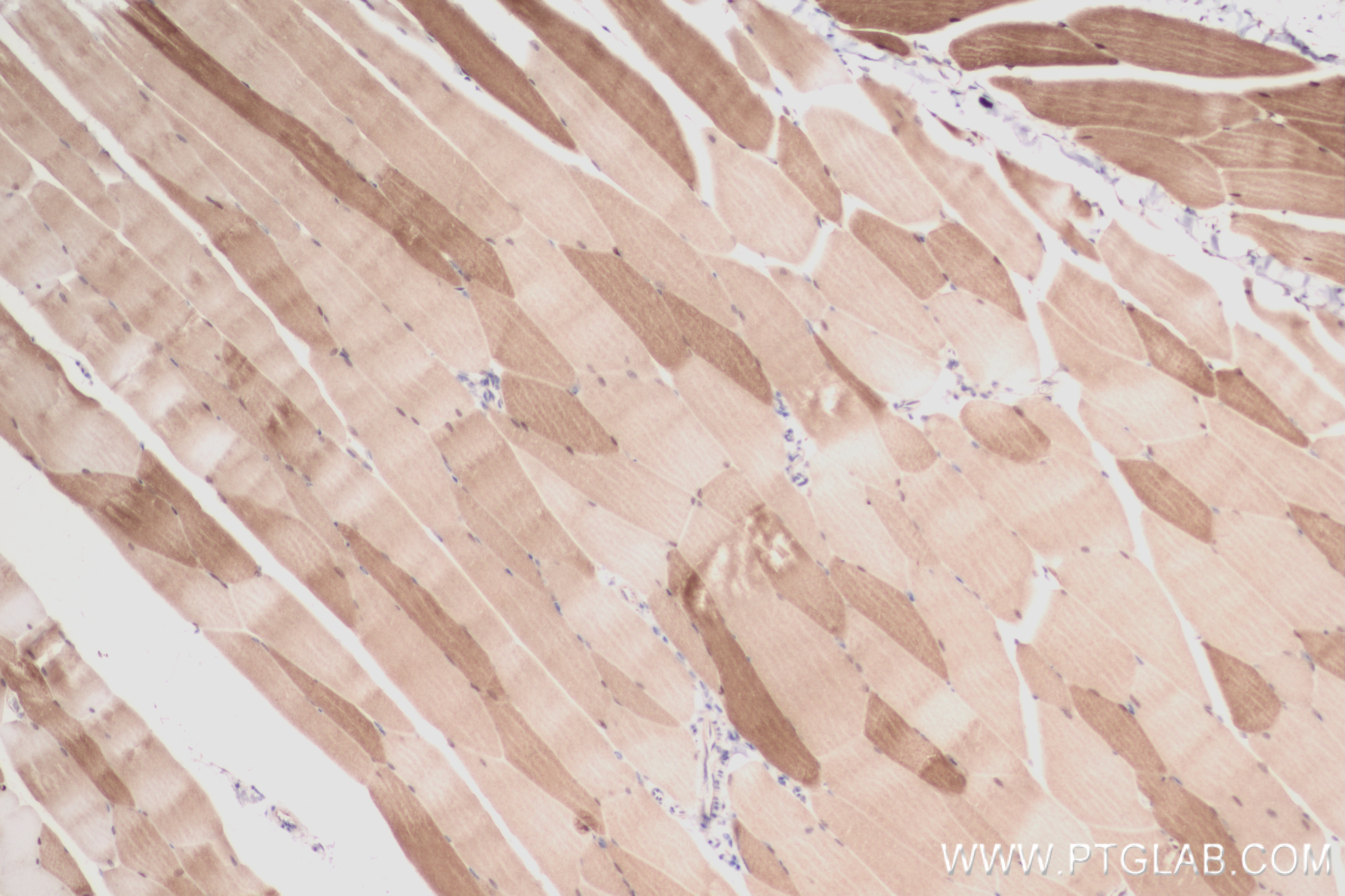 Immunohistochemistry (IHC) staining of mouse skeletal muscle tissue using FBP2 Recombinant antibody (83910-5-RR)