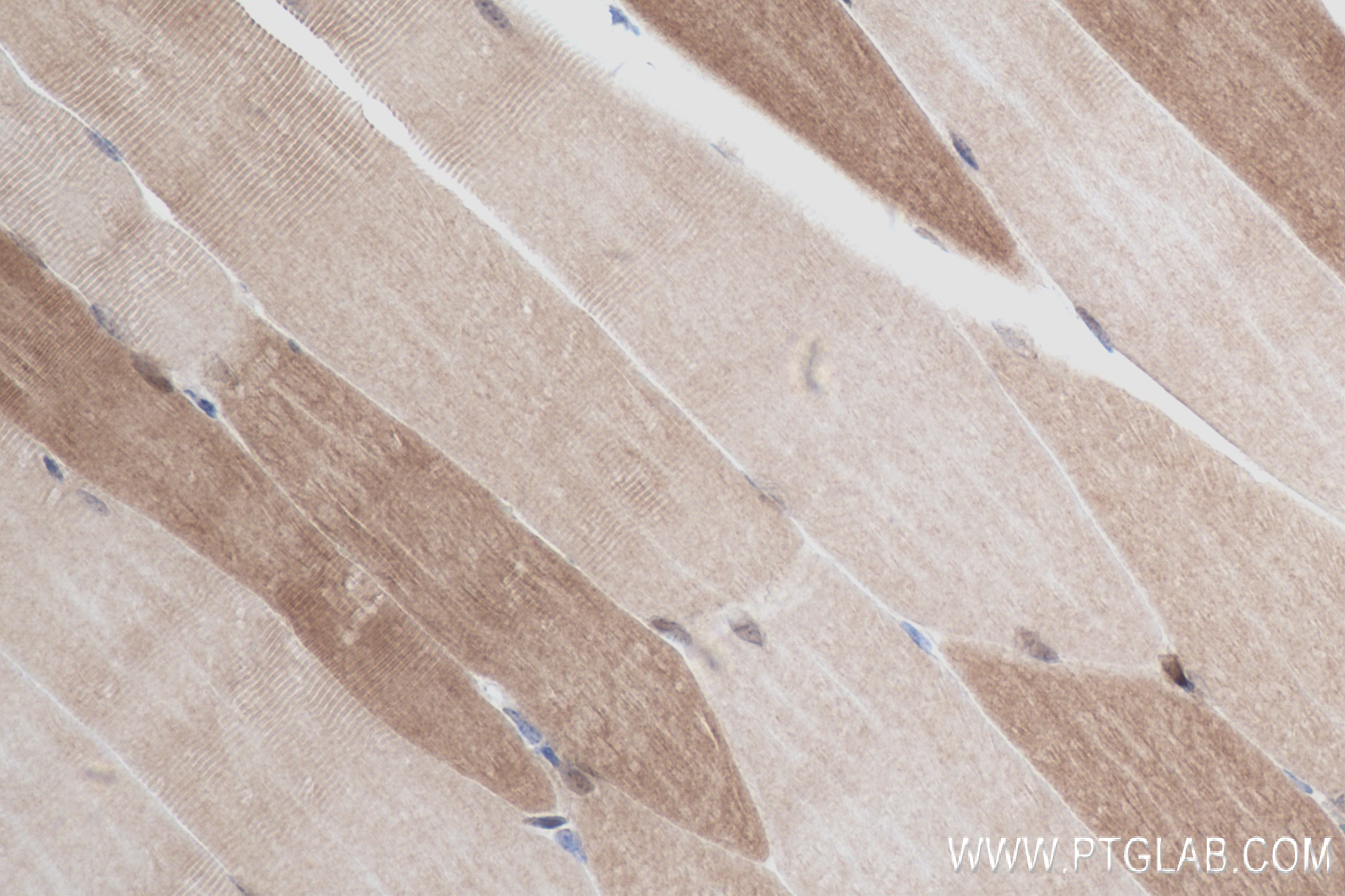 Immunohistochemistry (IHC) staining of mouse skeletal muscle tissue using FBP2 Recombinant antibody (83910-5-RR)