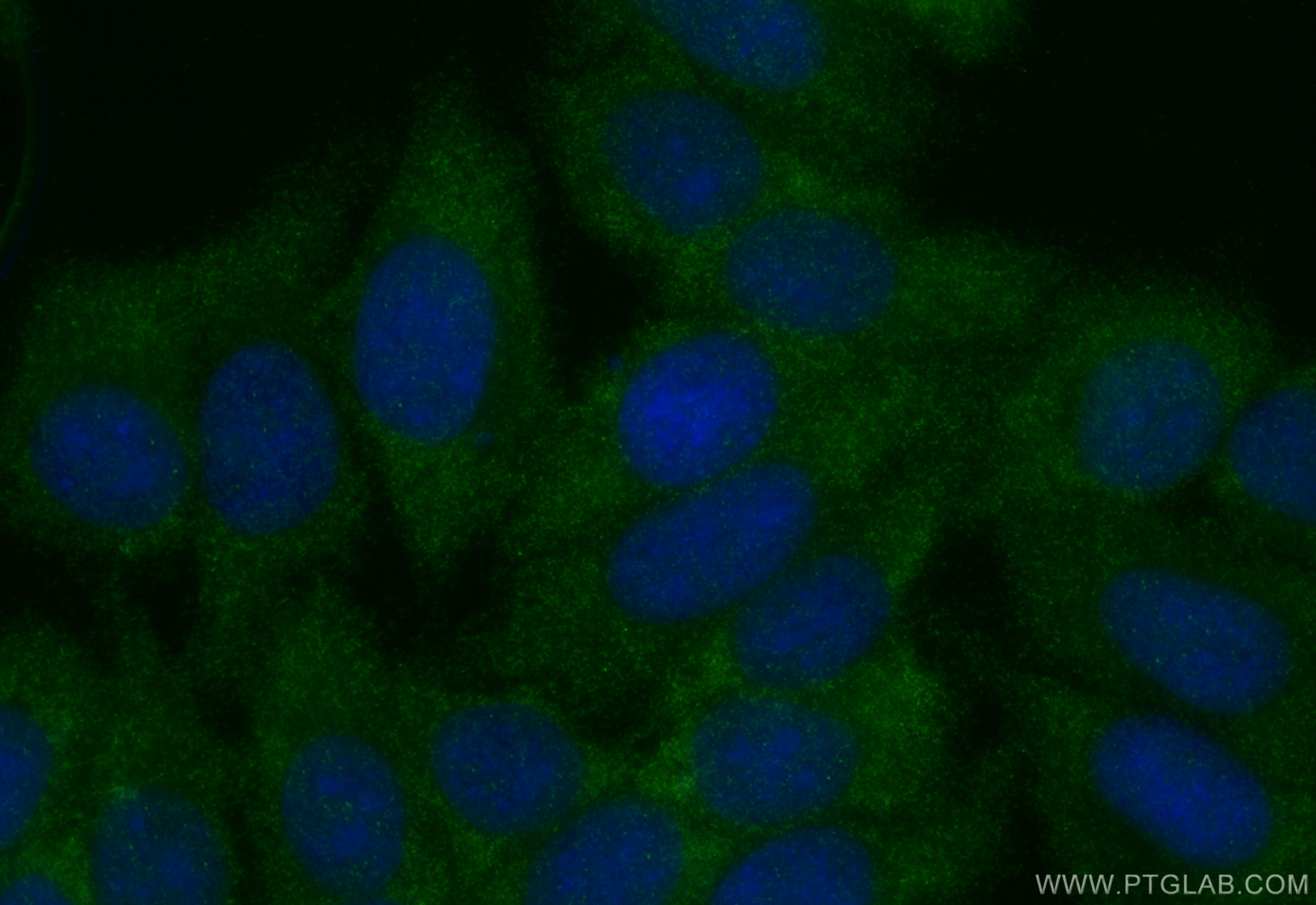 Immunofluorescence (IF) / fluorescent staining of HepG2 cells using FBXL14 Polyclonal antibody (13934-1-AP)