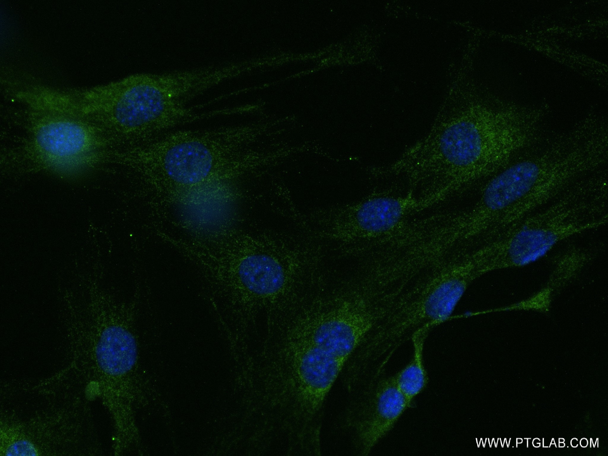 Immunofluorescence (IF) / fluorescent staining of C2C12 cells using FBXO32 Recombinant antibody (82941-1-RR)