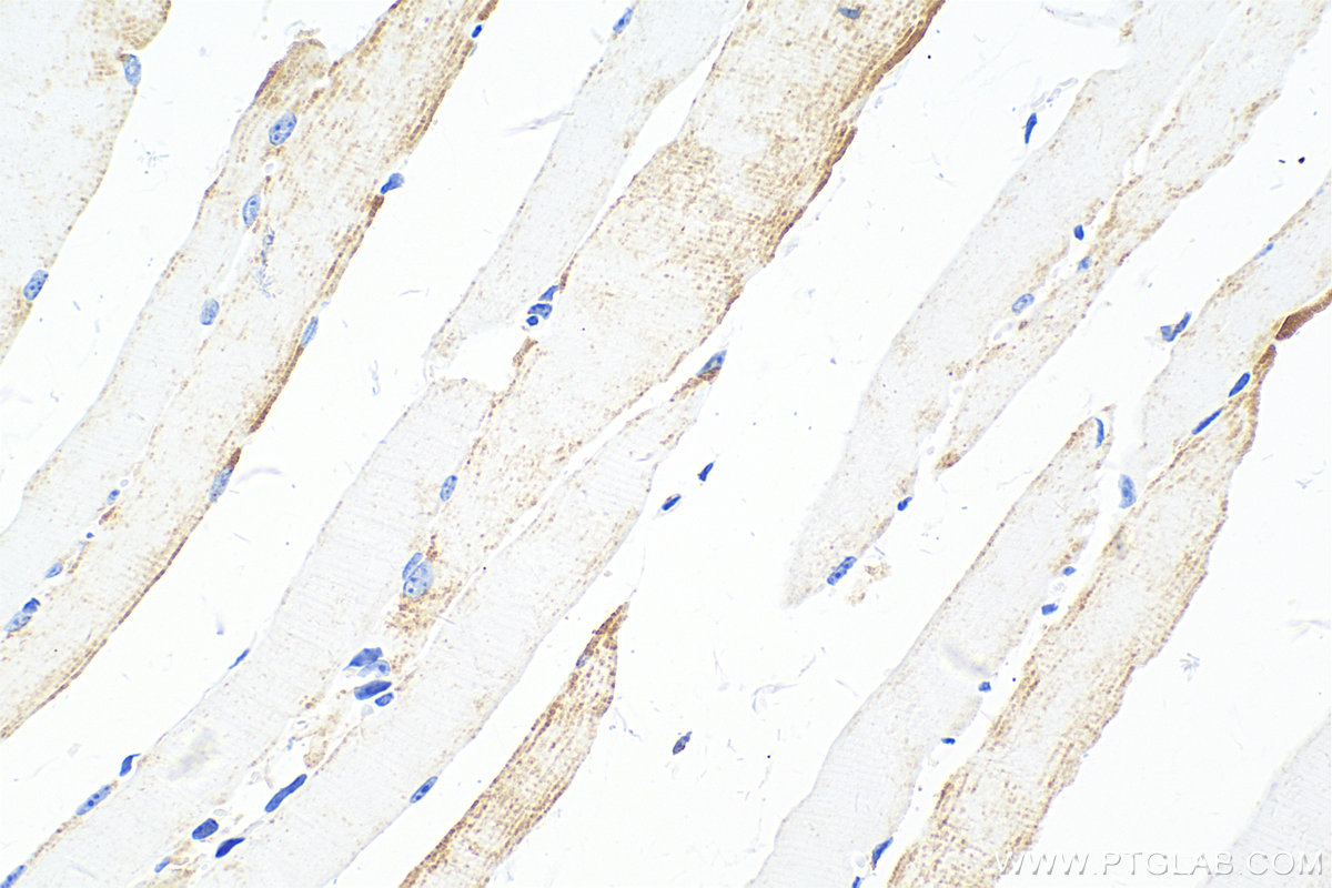 Immunohistochemistry (IHC) staining of mouse skeletal muscle tissue using FBXO32 Recombinant antibody (82941-1-RR)