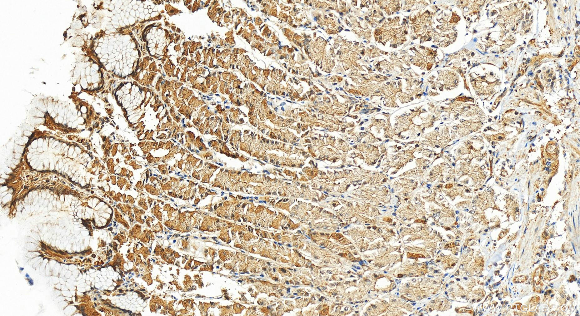 Immunohistochemistry (IHC) staining of human stomach tissue using FBXO7 Polyclonal antibody (10696-1-AP)