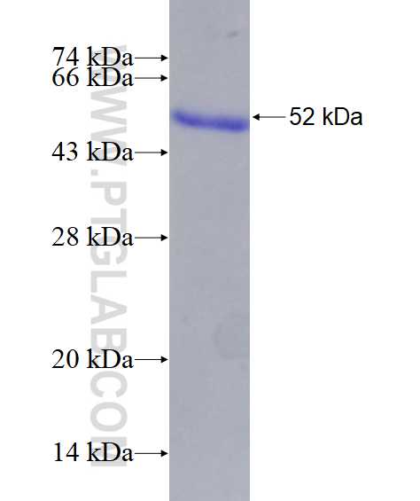 FC tag fusion protein Ag27844 SDS-PAGE