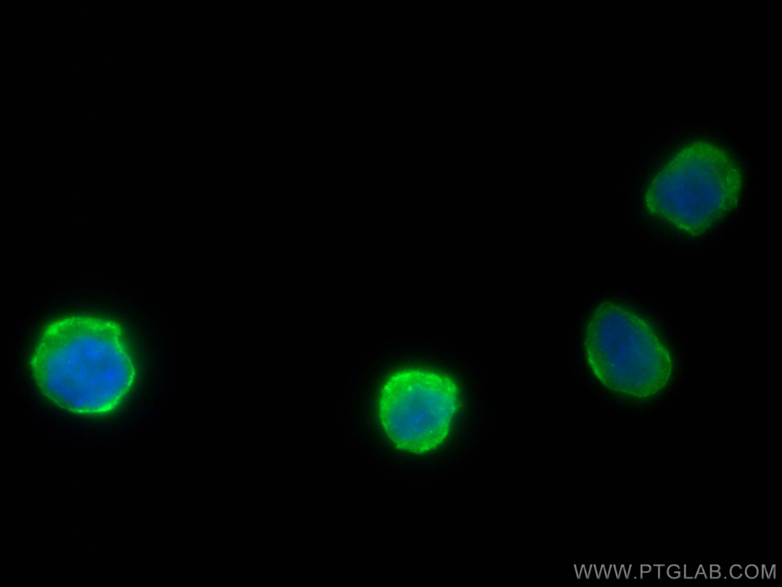 Immunofluorescence (IF) / fluorescent staining of THP-1 cells using FcRγ Polyclonal antibody (13566-1-AP)