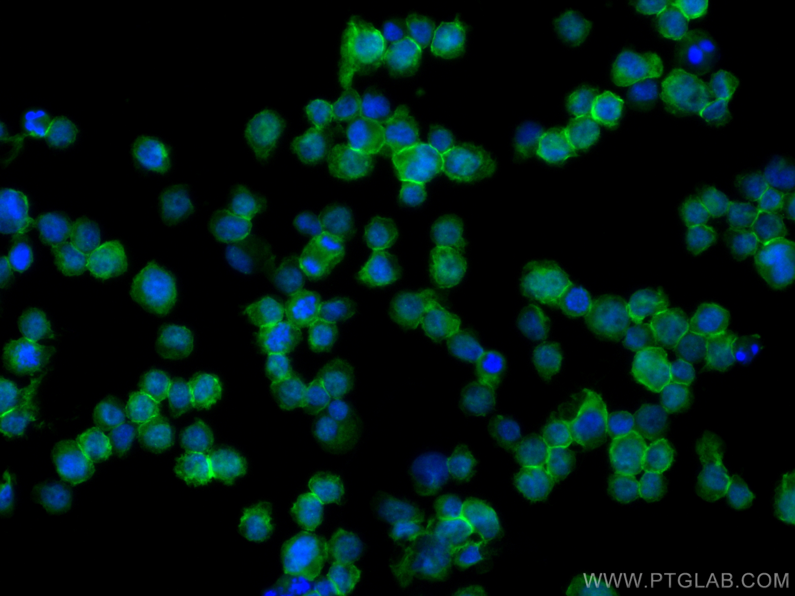 Immunofluorescence (IF) / fluorescent staining of THP-1 cells using CD64 Polyclonal antibody (27563-1-AP)