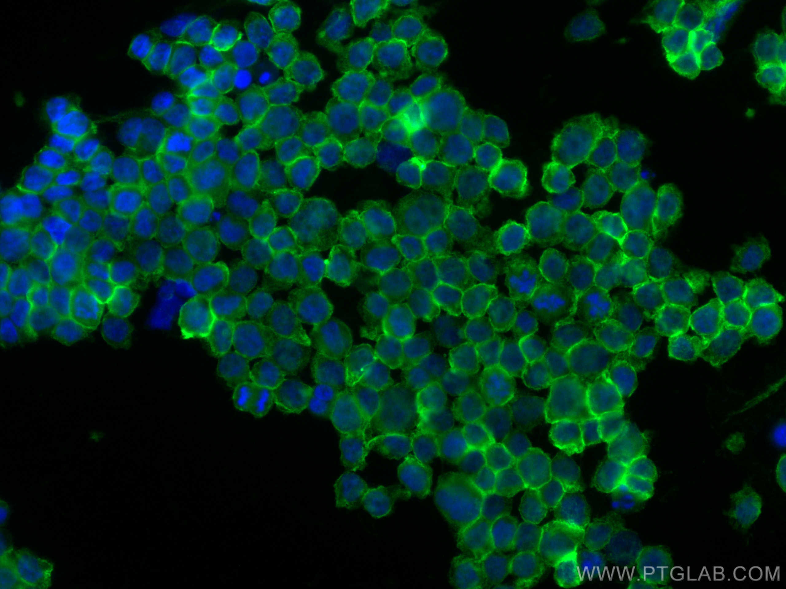 Immunofluorescence (IF) / fluorescent staining of THP-1 cells using FCGR2A / CD32a Polyclonal antibody (15625-1-AP)