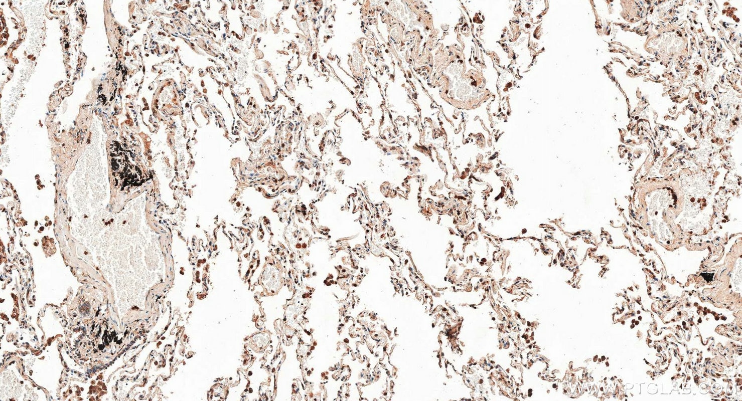 Immunohistochemistry (IHC) staining of human lung tissue using FCGR3B/CD16b Polyclonal antibody (30201-1-AP)