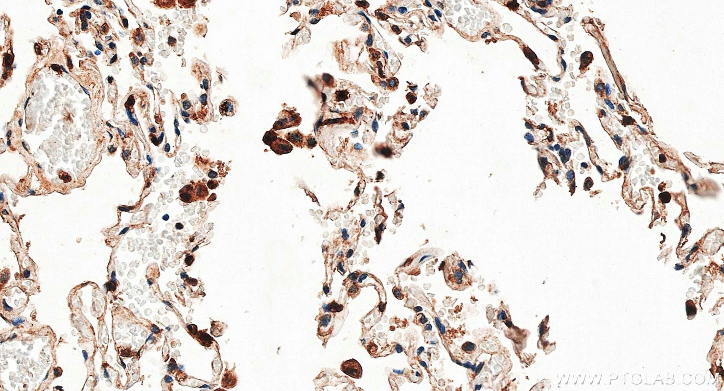 Immunohistochemistry (IHC) staining of human lung tissue using FCGR3B/CD16b Polyclonal antibody (30201-1-AP)