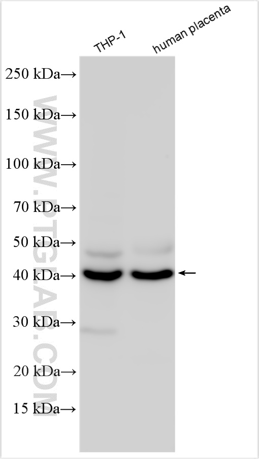 Western Blot (WB) analysis of various lysates using FcRn-Specific Polyclonal antibody (16190-1-AP)