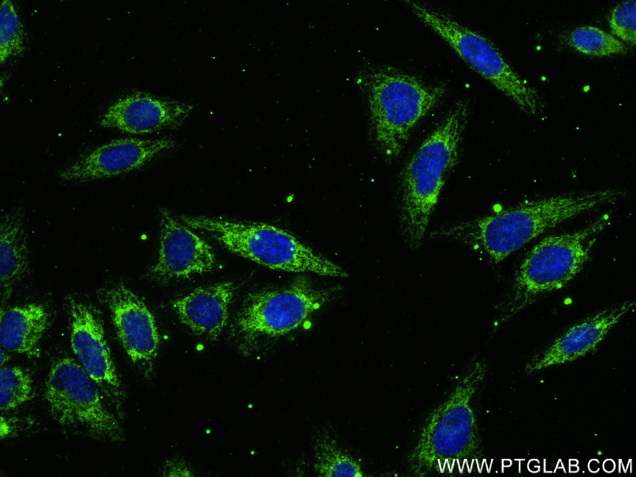 Immunofluorescence (IF) / fluorescent staining of HepG2 cells using FDX1 Recombinant antibody (82957-2-RR)