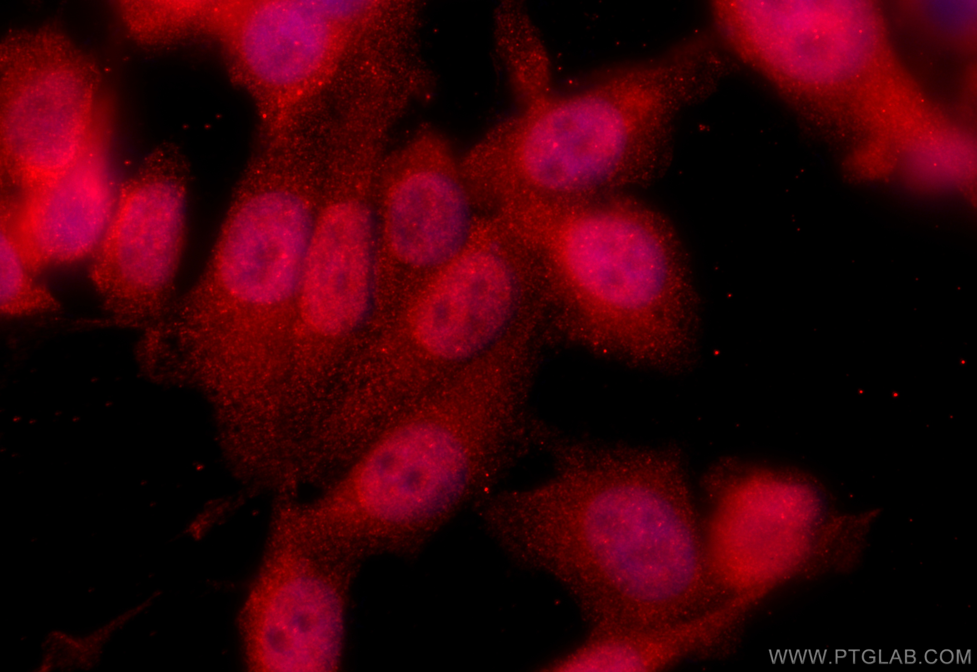 Immunofluorescence (IF) / fluorescent staining of PC-3 cells using FEM1B Polyclonal antibody (19544-1-AP)