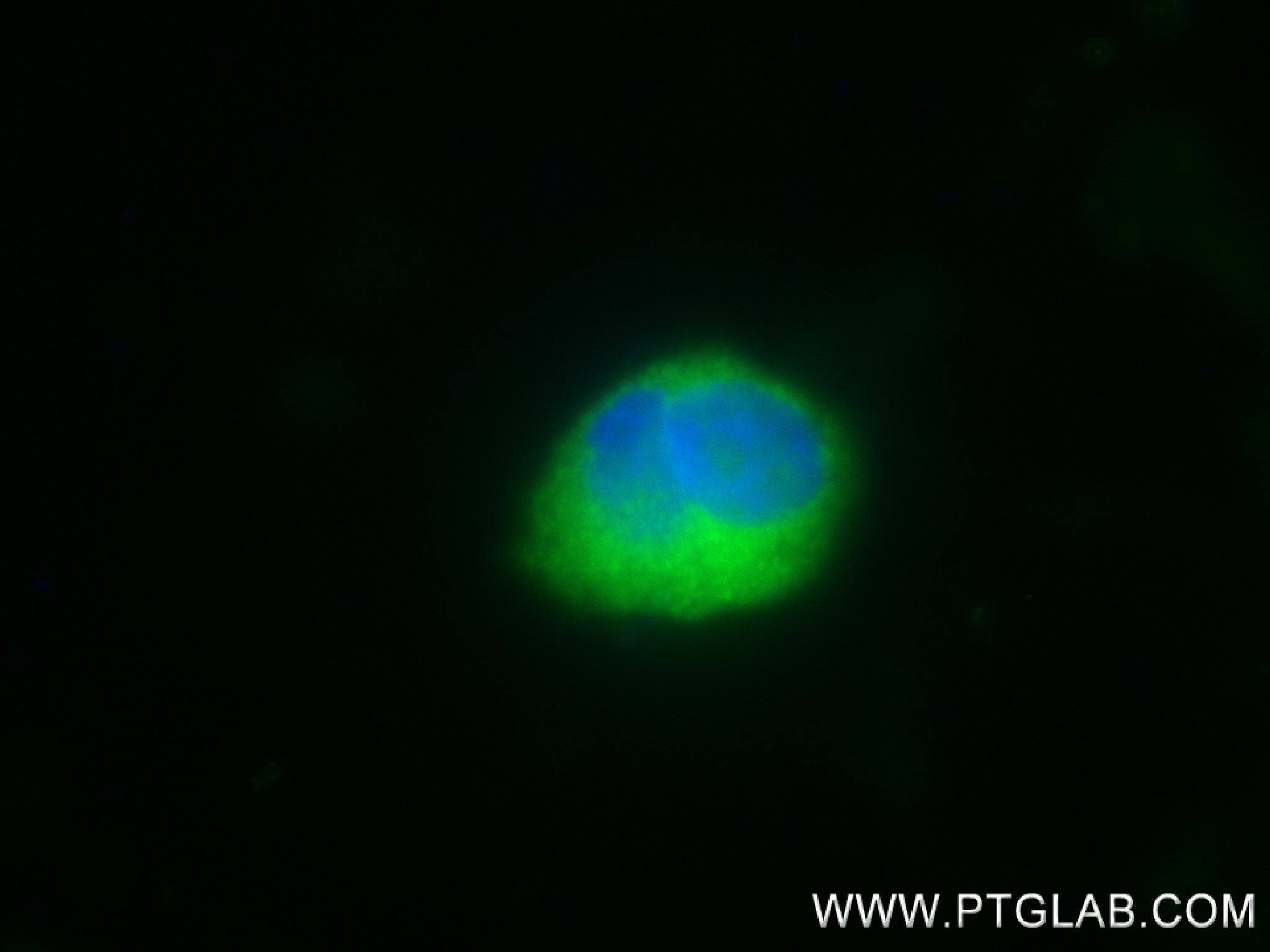 Immunofluorescence (IF) / fluorescent staining of PC-3 cells using FEM1B Recombinant antibody (83810-1-RR)