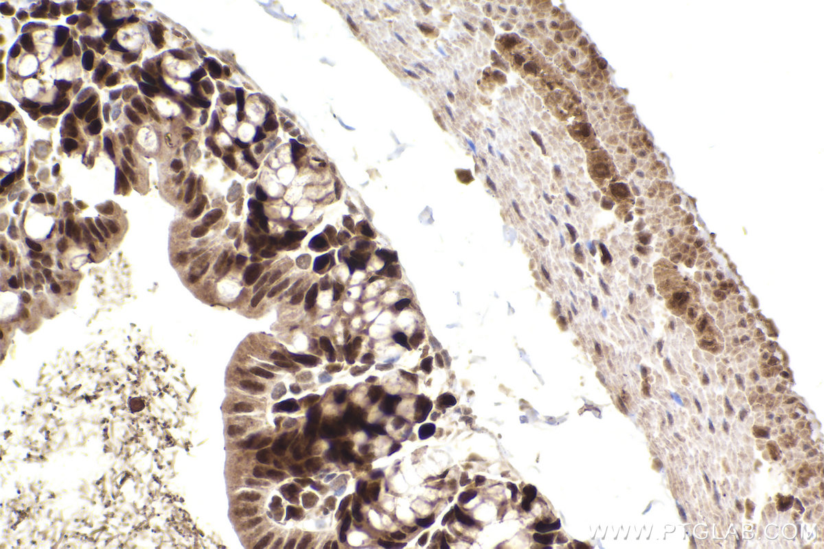 Immunohistochemistry (IHC) staining of mouse small intestine tissue using FEN1 Polyclonal antibody (14768-1-AP)