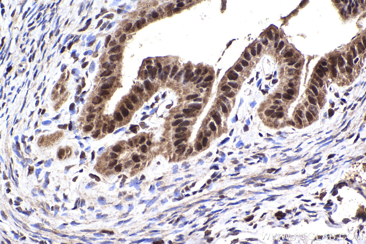 Immunohistochemistry (IHC) staining of mouse ovary tissue using FEN1 Polyclonal antibody (14768-1-AP)