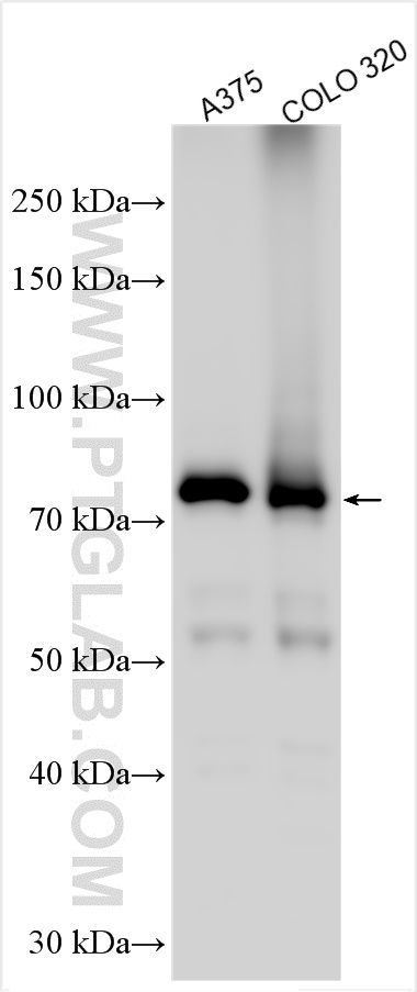 Western Blot (WB) analysis of various lysates using Kindlin 1 Polyclonal antibody (22215-1-AP)