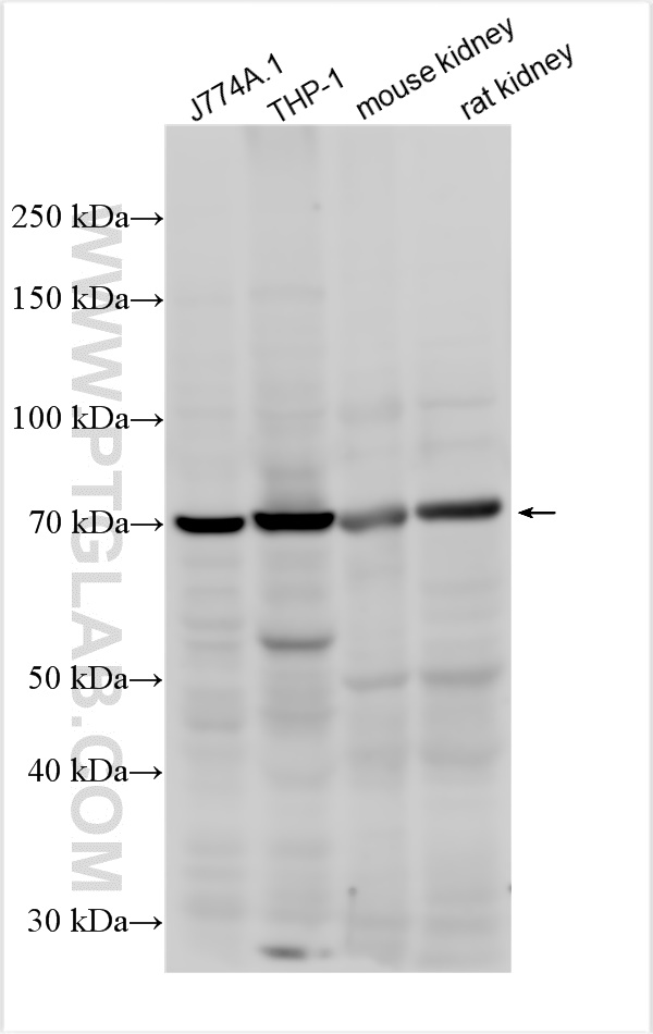 Western Blot (WB) analysis of various lysates using Kindlin 3 Polyclonal antibody (18131-1-AP)