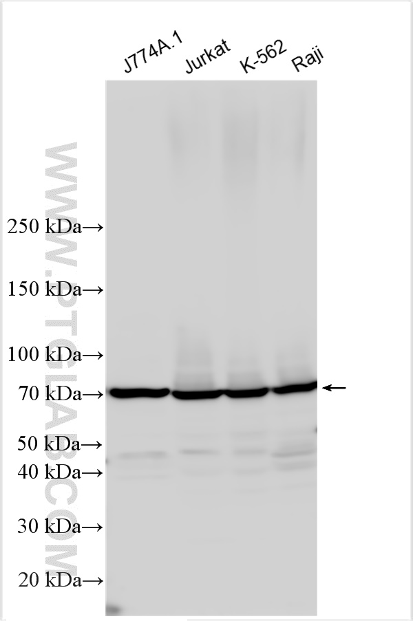 Western Blot (WB) analysis of various lysates using Kindlin 3 Polyclonal antibody (18131-1-AP)