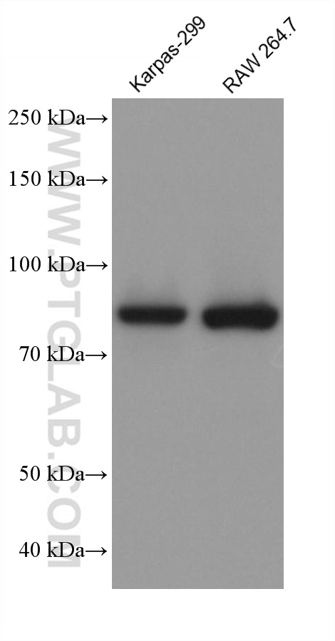 Western Blot (WB) analysis of Karpas-299 cells using FES Monoclonal antibody (67524-1-Ig)