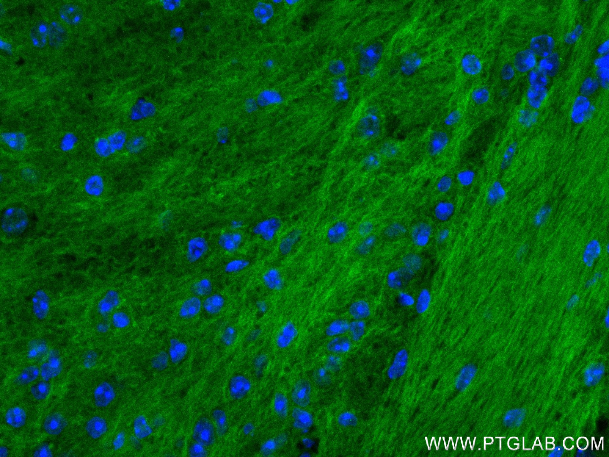 Immunofluorescence (IF) / fluorescent staining of mouse brain tissue using FFAR2 Recombinant antibody (84544-1-RR)