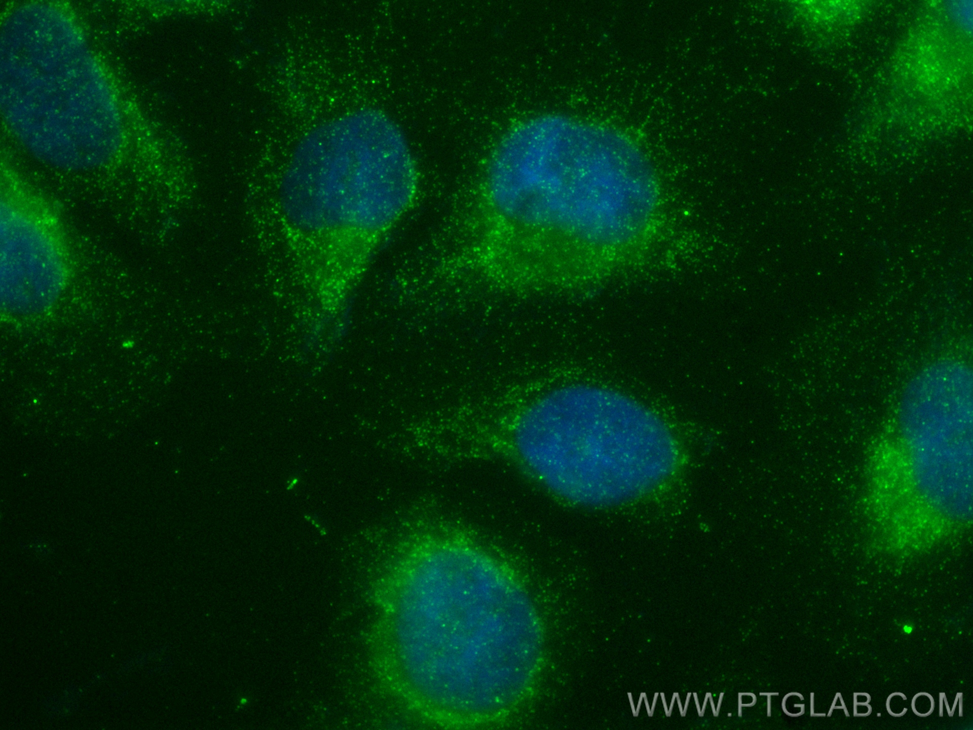 Immunofluorescence (IF) / fluorescent staining of U2OS cells using FGD1 Polyclonal antibody (13141-1-AP)