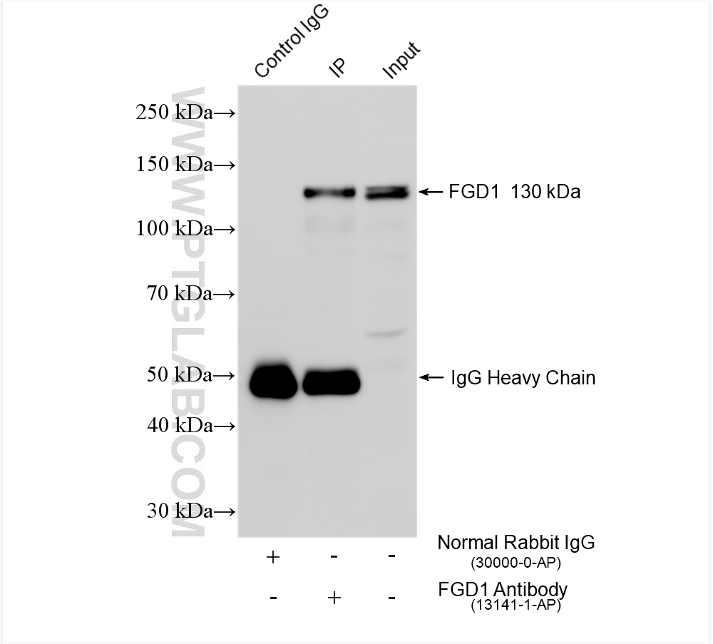 Immunoprecipitation (IP) experiment of SK-N-SH cells using FGD1 Polyclonal antibody (13141-1-AP)