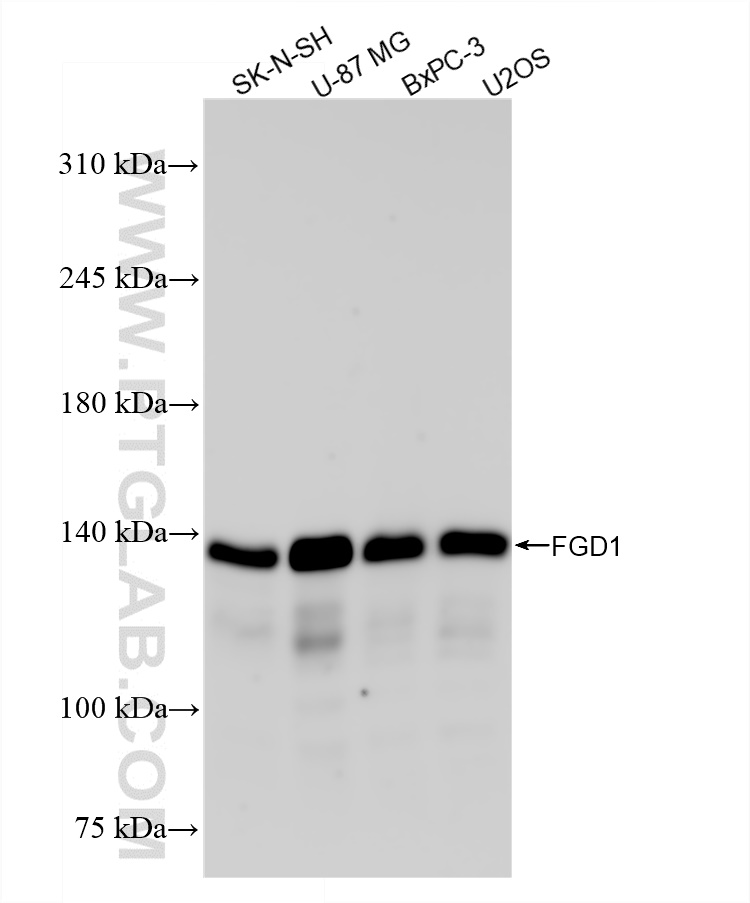 Western Blot (WB) analysis of various lysates using FGD1 Recombinant antibody (84783-2-RR)