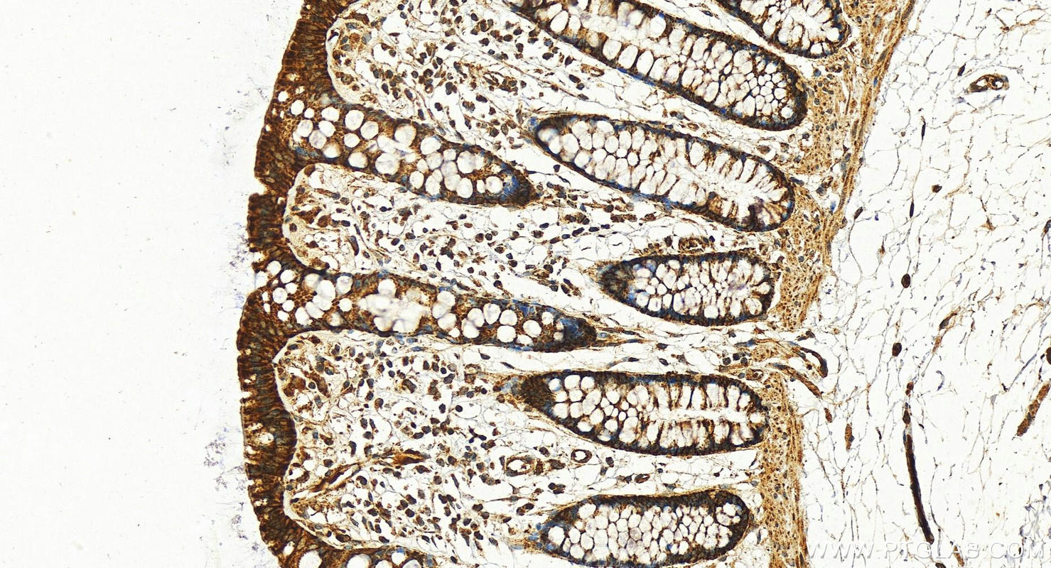 Immunohistochemistry (IHC) staining of human colon tissue using FGFR1 Polyclonal antibody (30358-1-AP)