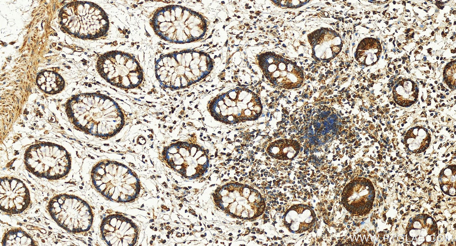 Immunohistochemistry (IHC) staining of human colon tissue using FGFR1 Polyclonal antibody (30358-1-AP)