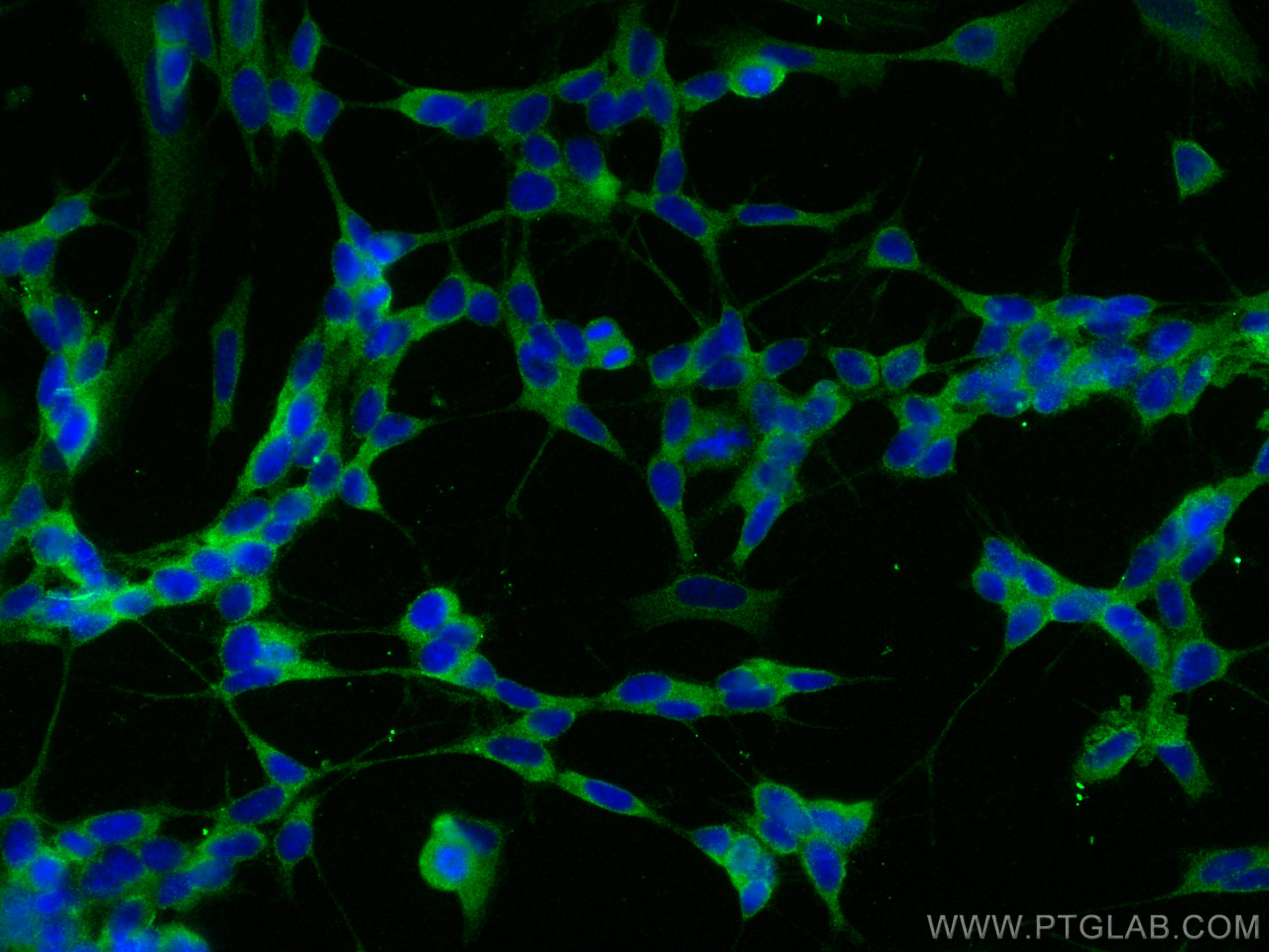 Immunofluorescence (IF) / fluorescent staining of SH-SY5Y cells using FGFR1 Polyclonal antibody (30358-1-AP)