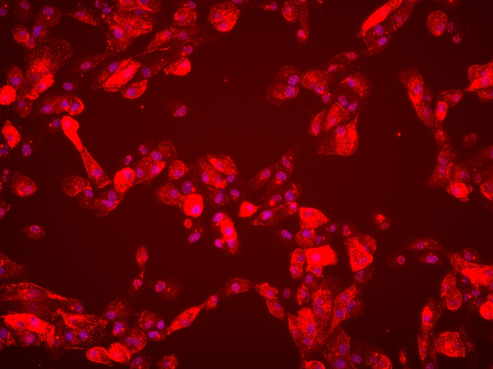 Immunofluorescence (IF) / fluorescent staining of ACHN cells using FGFR1 Monoclonal antibody (60325-1-Ig)