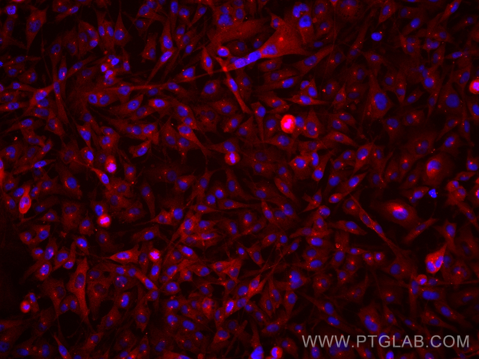 Immunofluorescence (IF) / fluorescent staining of BT-549 cells using FGFR1OP Monoclonal antibody (67207-1-Ig)