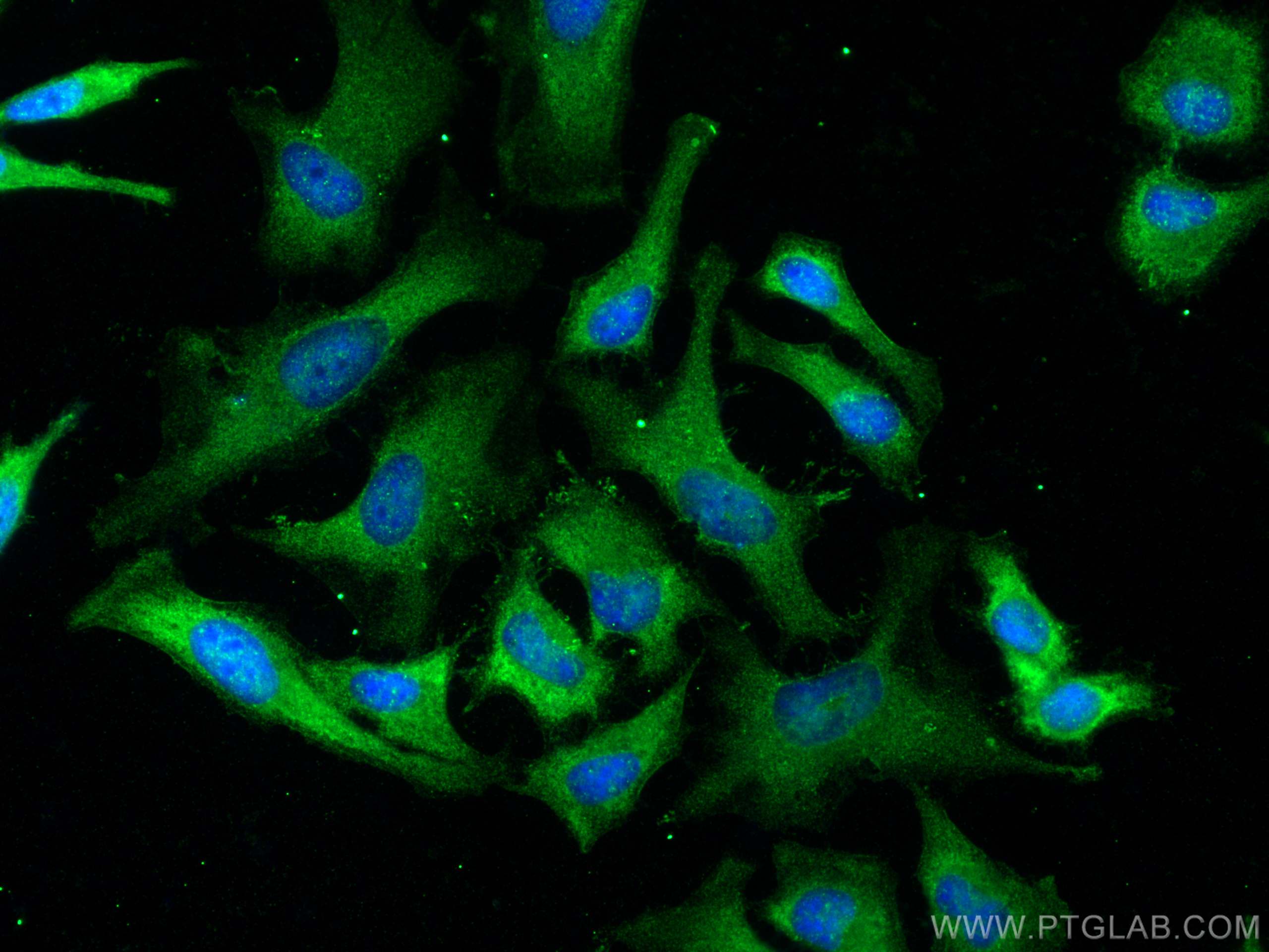 Immunofluorescence (IF) / fluorescent staining of HeLa cells using FGFR2 Polyclonal antibody (13042-1-AP)