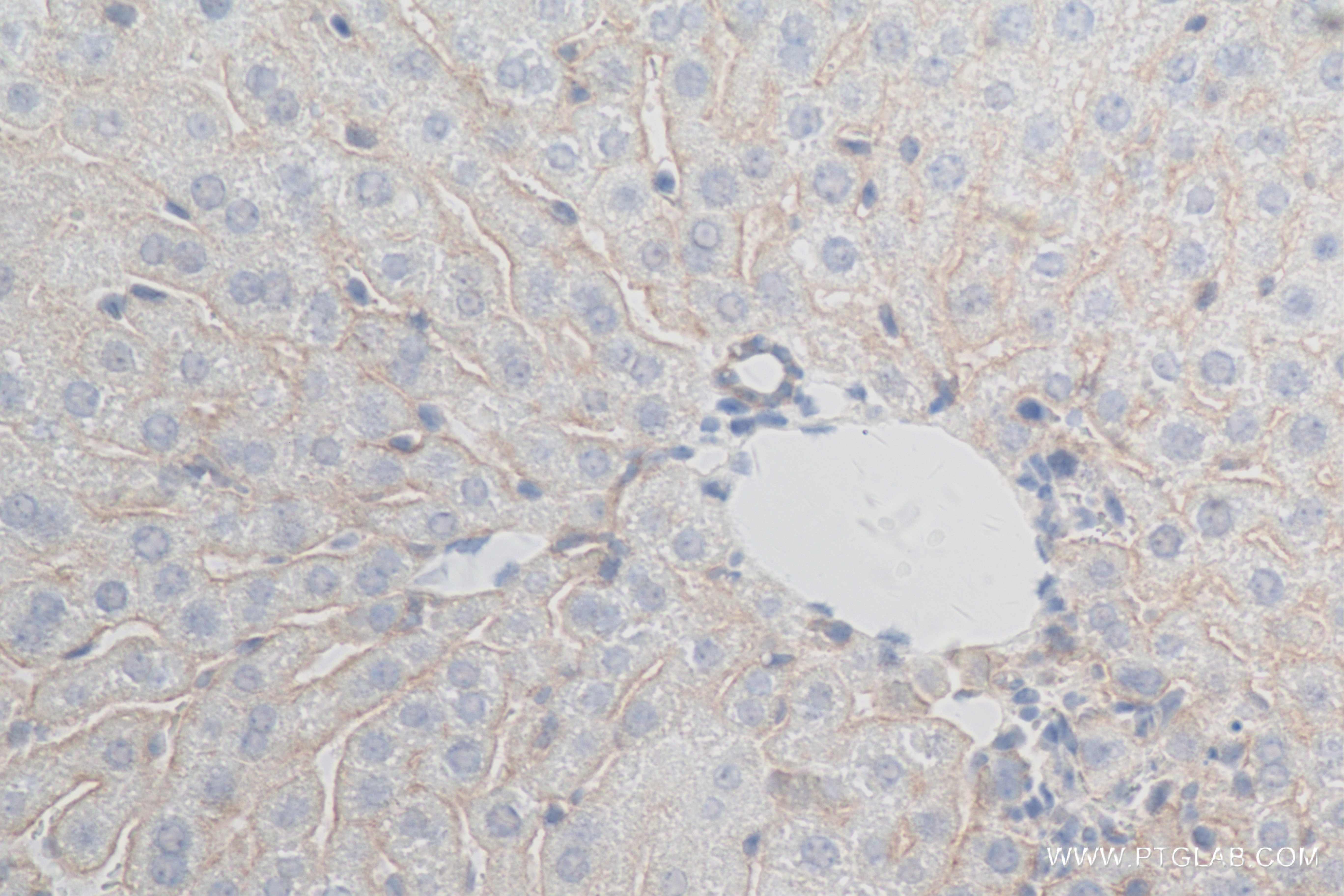 Immunohistochemistry (IHC) staining of mouse liver tissue using FGFR2 Recombinant antibody (84205-4-RR)