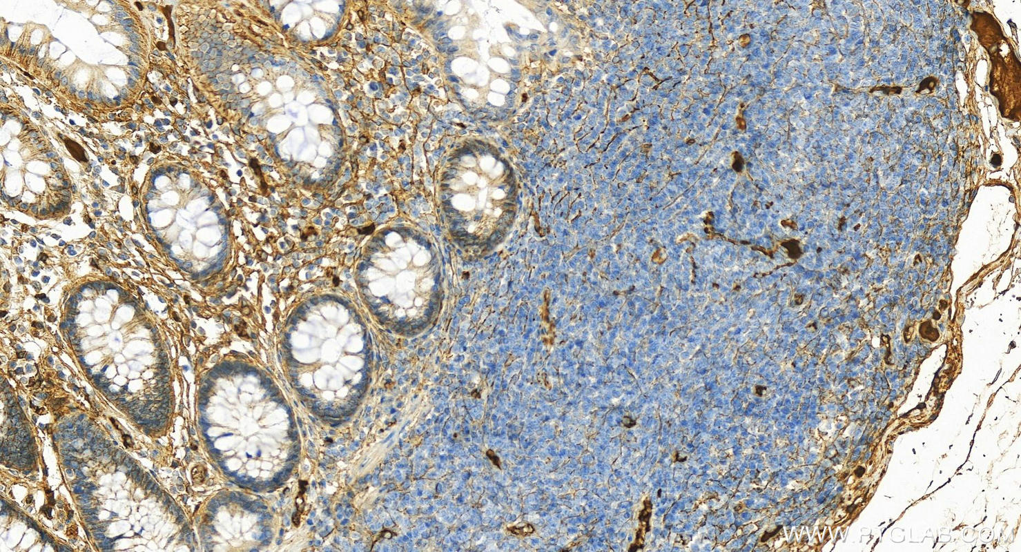 Immunohistochemistry (IHC) staining of human normal colon using Fibrinogen Gamma Chain Polyclonal antibody (15841-1-AP)