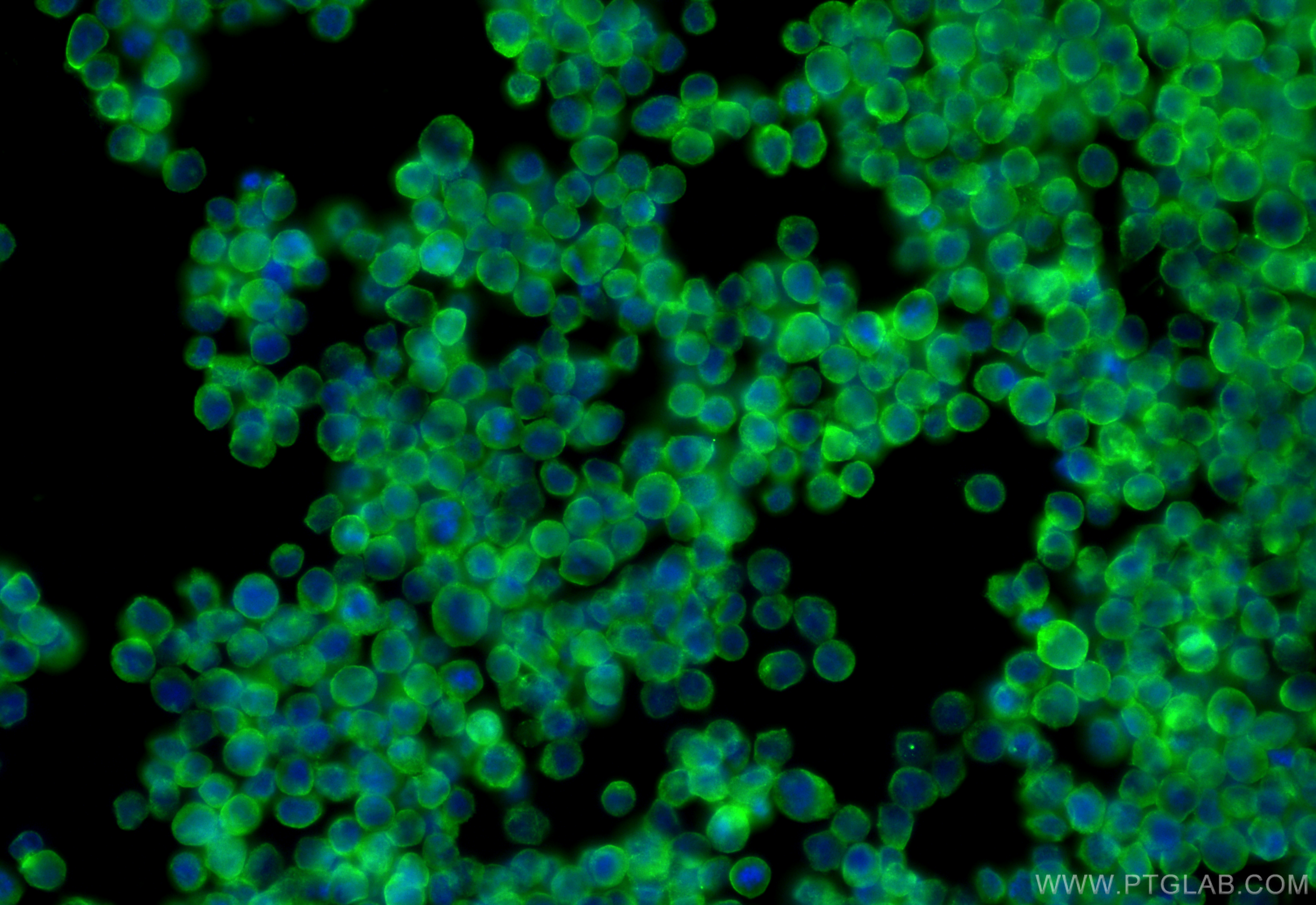 Immunofluorescence (IF) / fluorescent staining of Raji cells using FGR Polyclonal antibody (31641-1-AP)