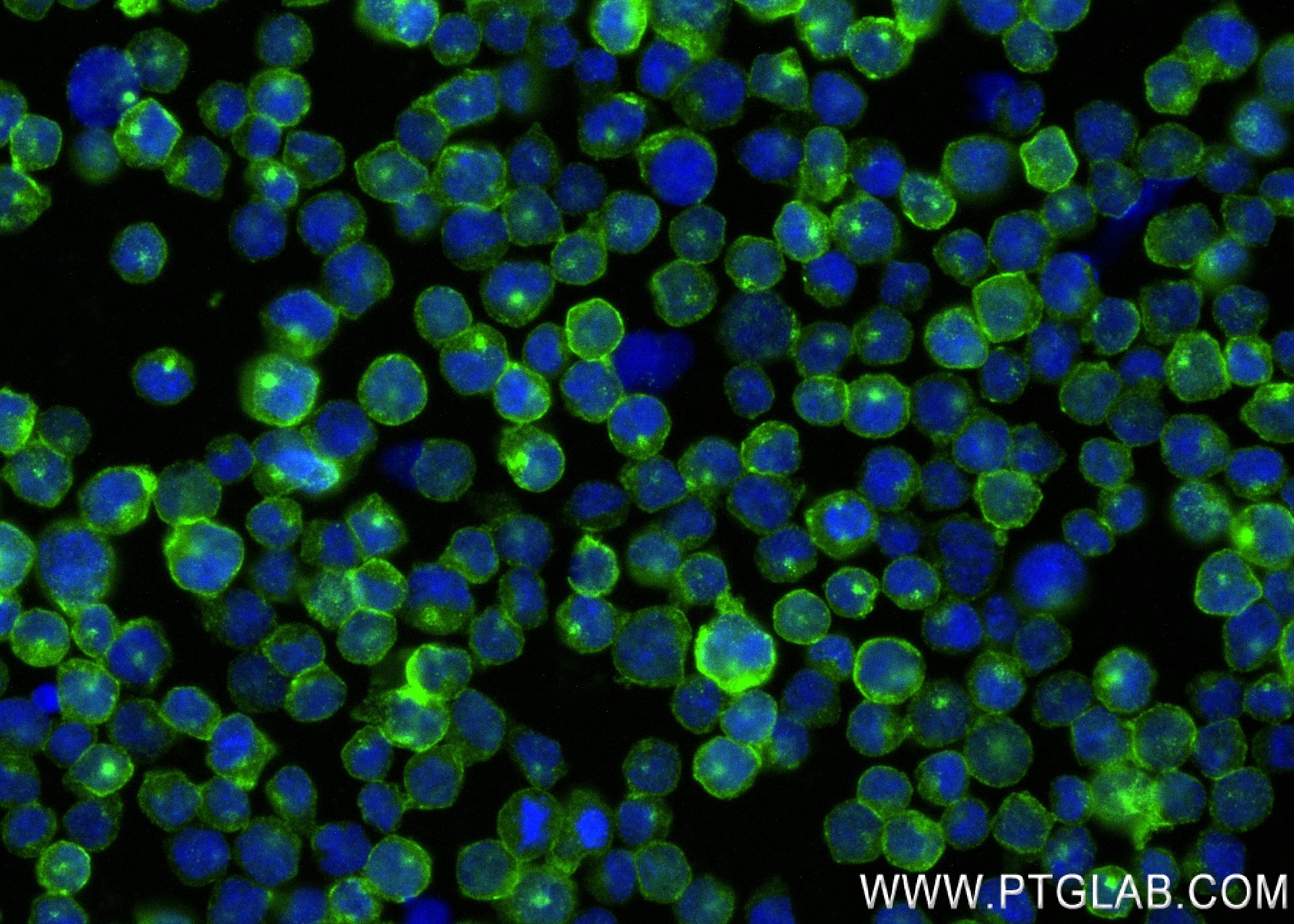 Immunofluorescence (IF) / fluorescent staining of Raji cells using FGR Recombinant antibody (83352-1-RR)