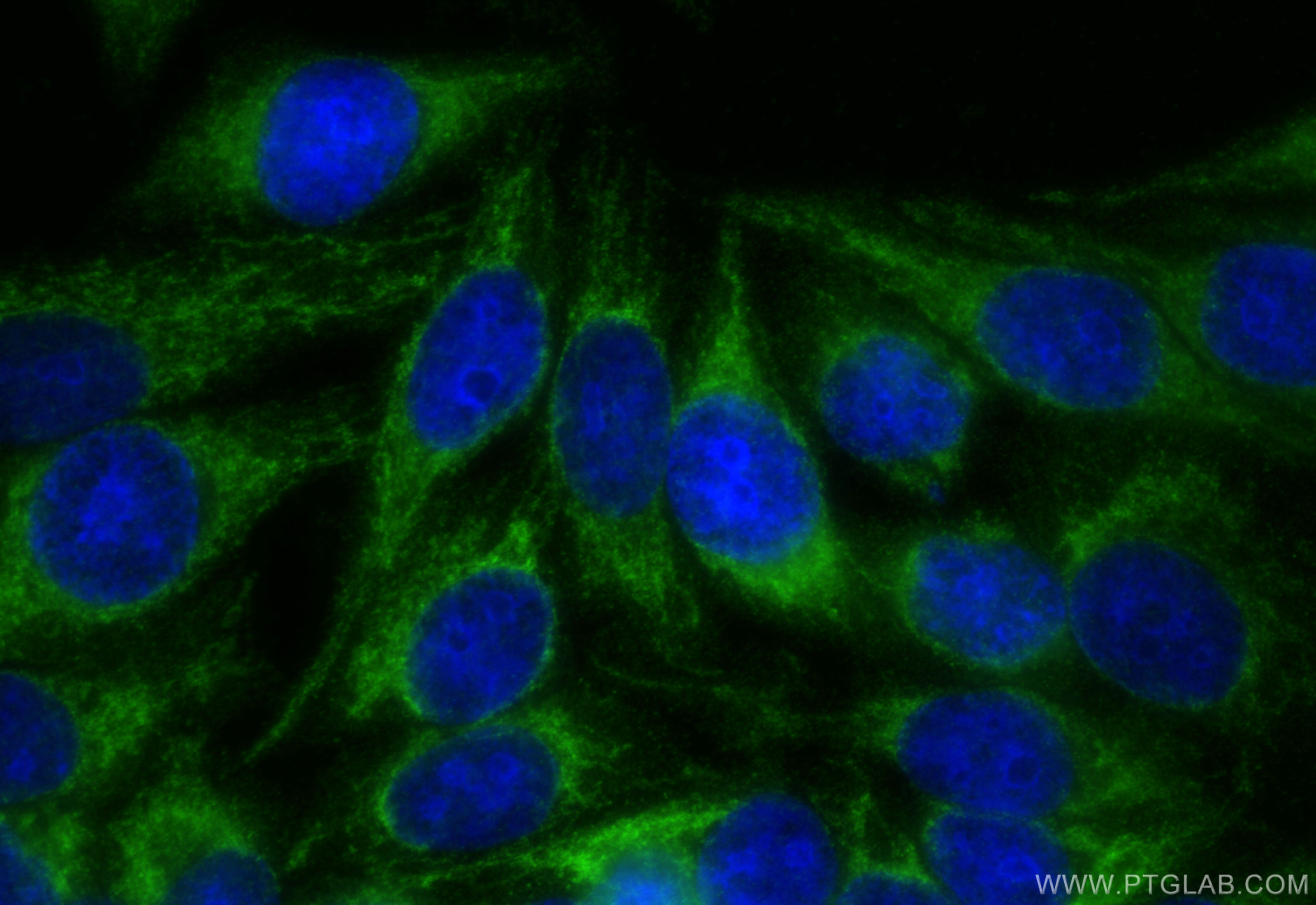 Immunofluorescence (IF) / fluorescent staining of HepG2 cells using FH Polyclonal antibody (10966-1-AP)