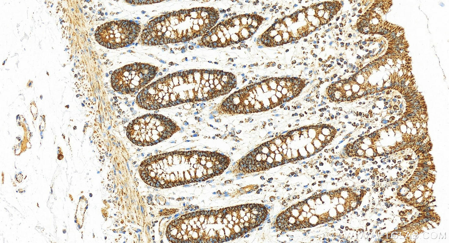 Immunohistochemistry (IHC) staining of human normal colon using FH Polyclonal antibody (11375-1-AP)