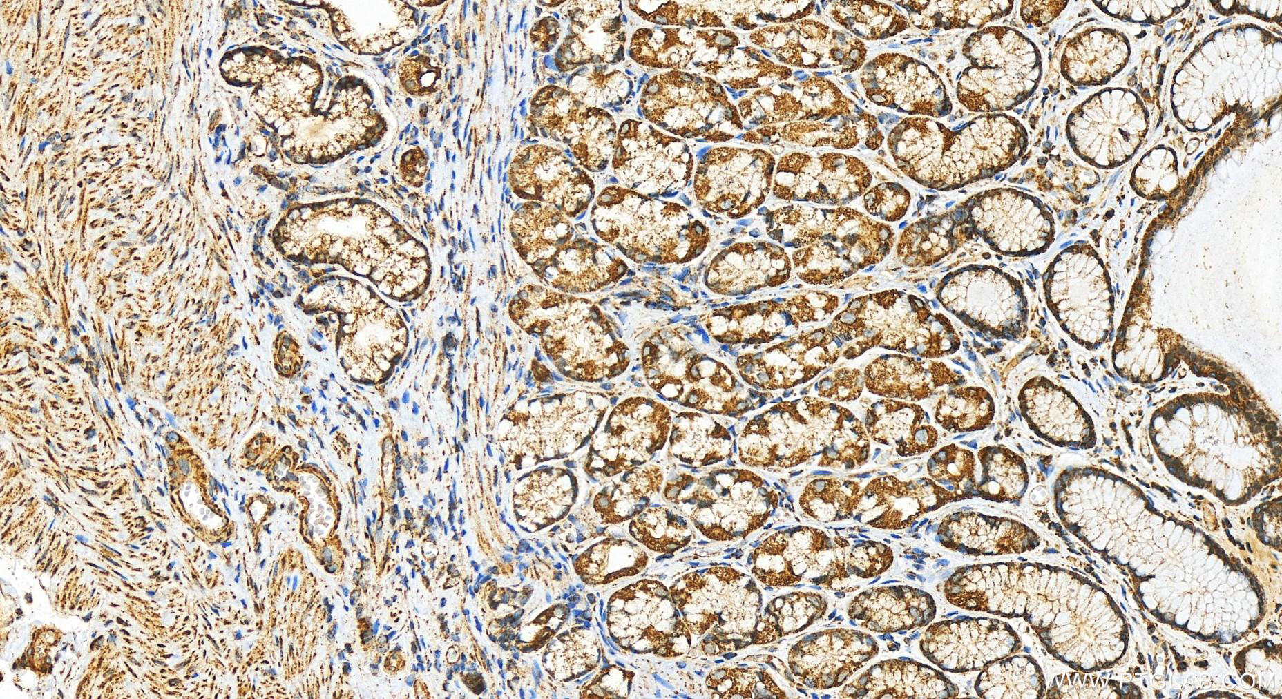 Immunohistochemistry (IHC) staining of human stomach tissue using FH Recombinant antibody (82508-1-RR)