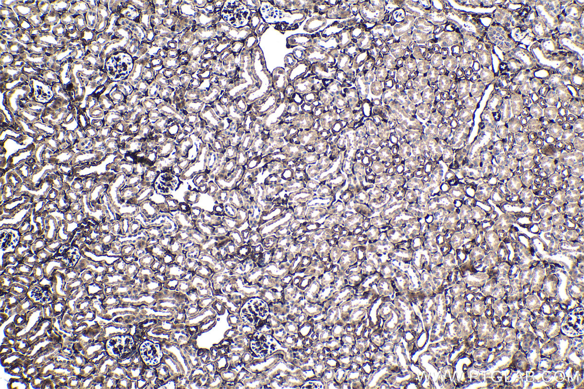 Immunohistochemistry (IHC) staining of mouse kidney tissue using FHL2 Polyclonal antibody (21619-1-AP)