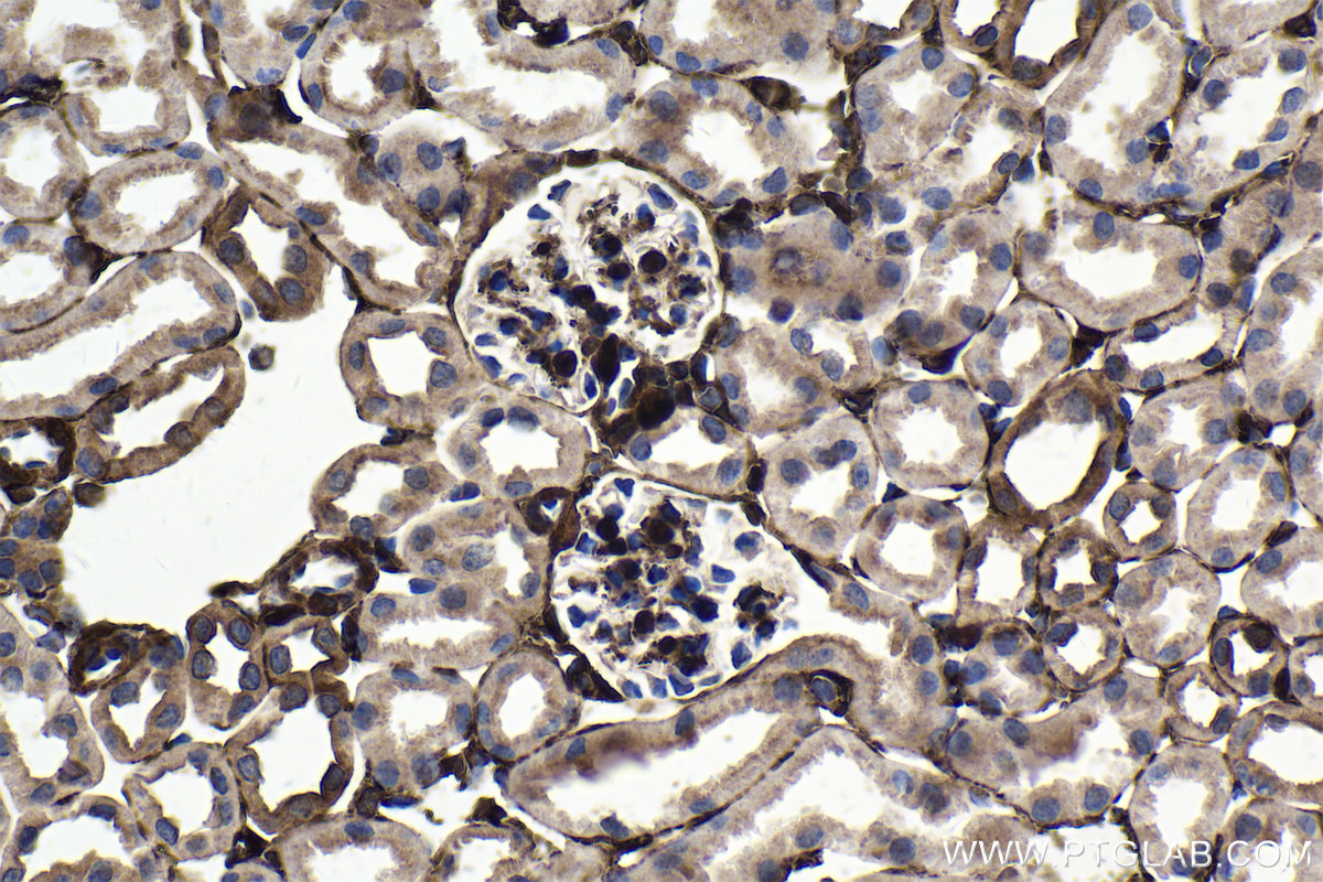 Immunohistochemistry (IHC) staining of mouse kidney tissue using FHL2 Polyclonal antibody (21619-1-AP)