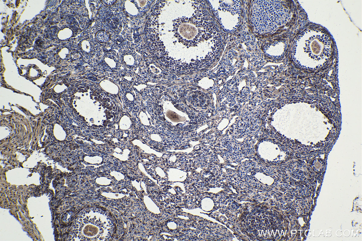 Immunohistochemistry (IHC) staining of mouse ovary tissue using FHL2 Polyclonal antibody (21619-1-AP)