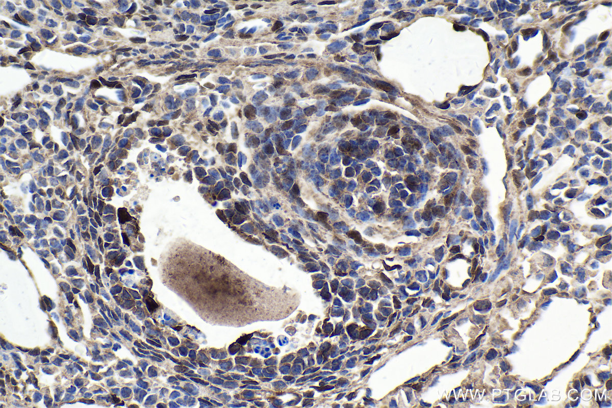 Immunohistochemistry (IHC) staining of mouse ovary tissue using FHL2 Polyclonal antibody (21619-1-AP)