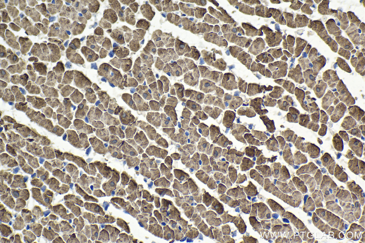 Immunohistochemistry (IHC) staining of rat heart tissue using FHL2 Polyclonal antibody (21619-1-AP)