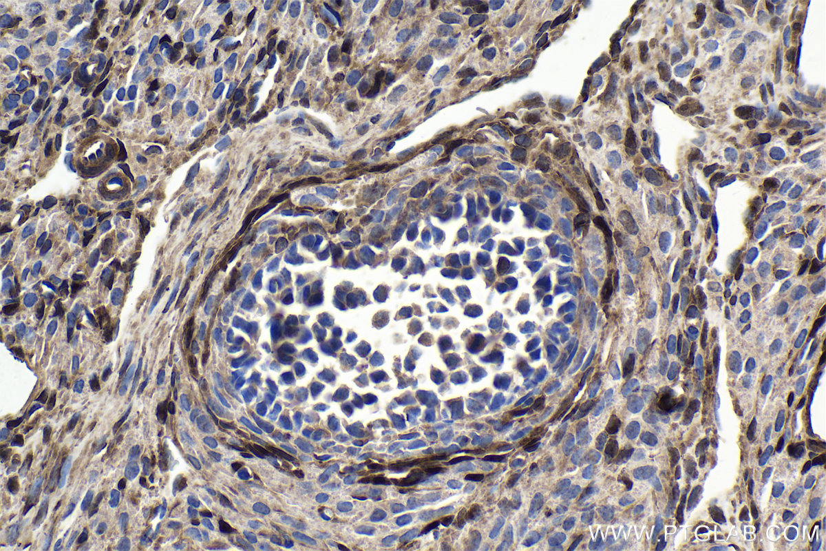 Immunohistochemistry (IHC) staining of rat ovary tissue using FHL2 Polyclonal antibody (21619-1-AP)