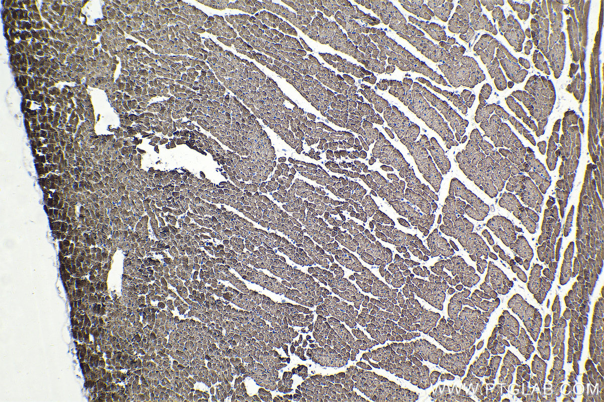 Immunohistochemistry (IHC) staining of rat heart tissue using FHL2 Polyclonal antibody (21619-1-AP)