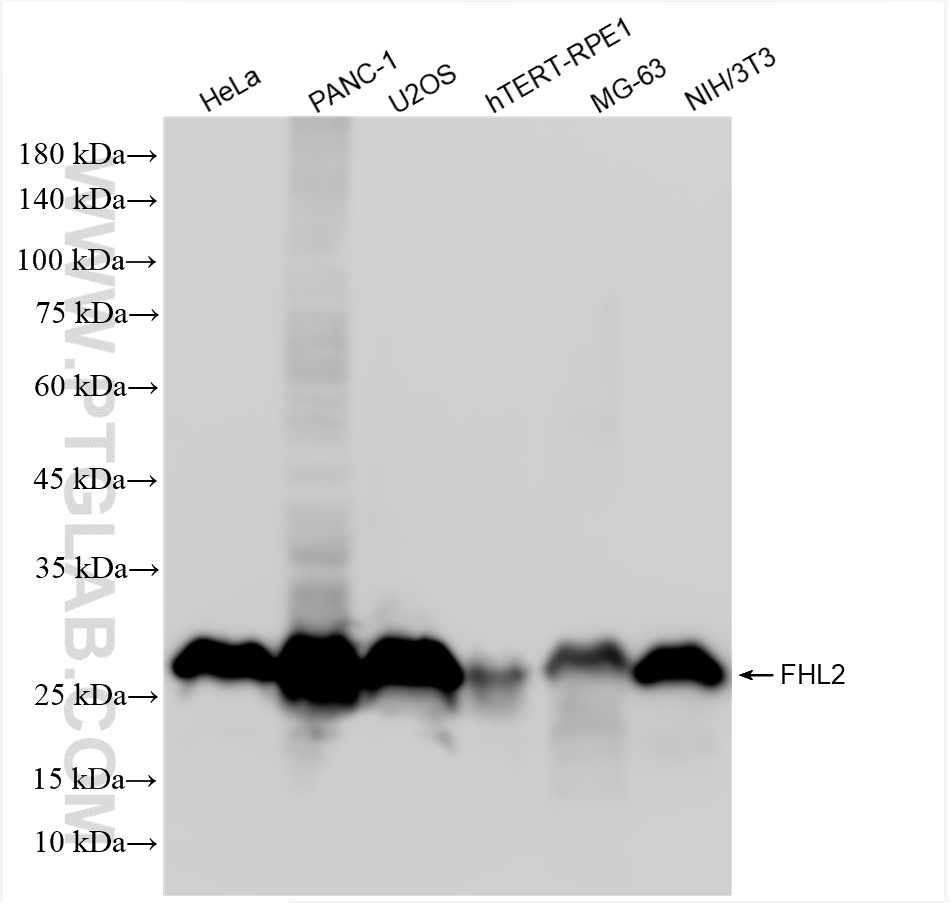 Western Blot (WB) analysis of various lysates using FHL2 Recombinant antibody (86060-1-RR)