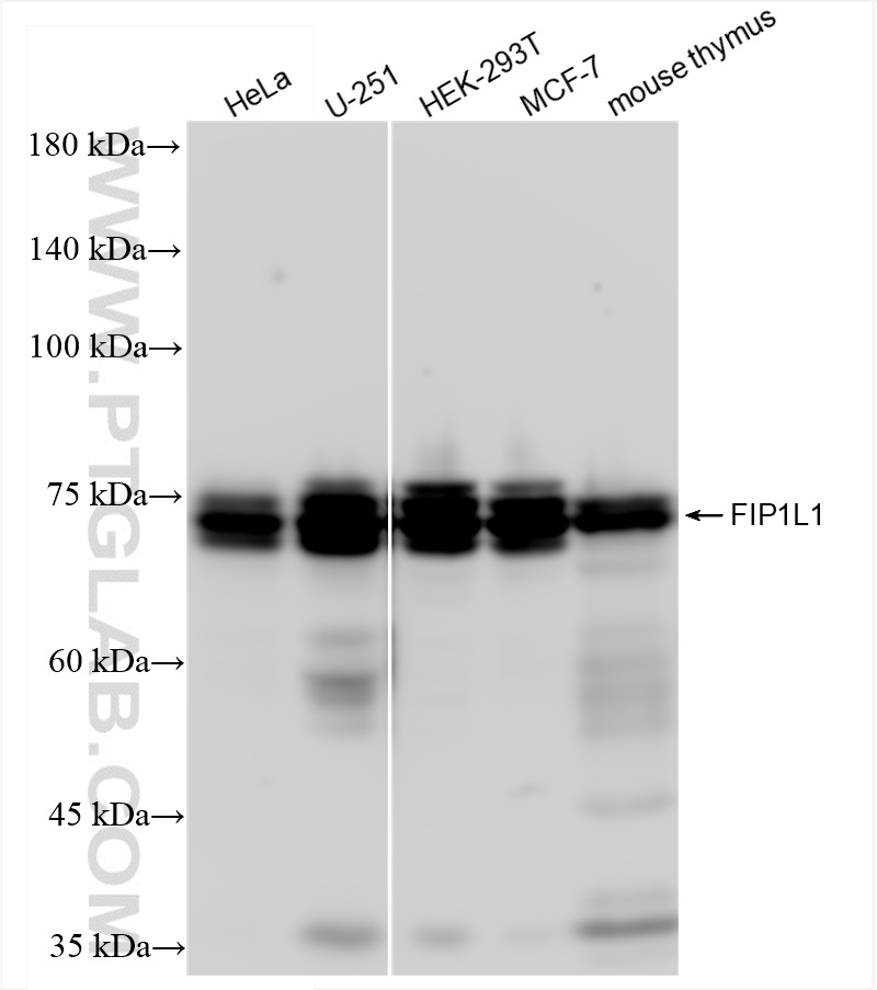 Western Blot (WB) analysis of various lysates using FIP1L1 Recombinant antibody (83863-2-RR)