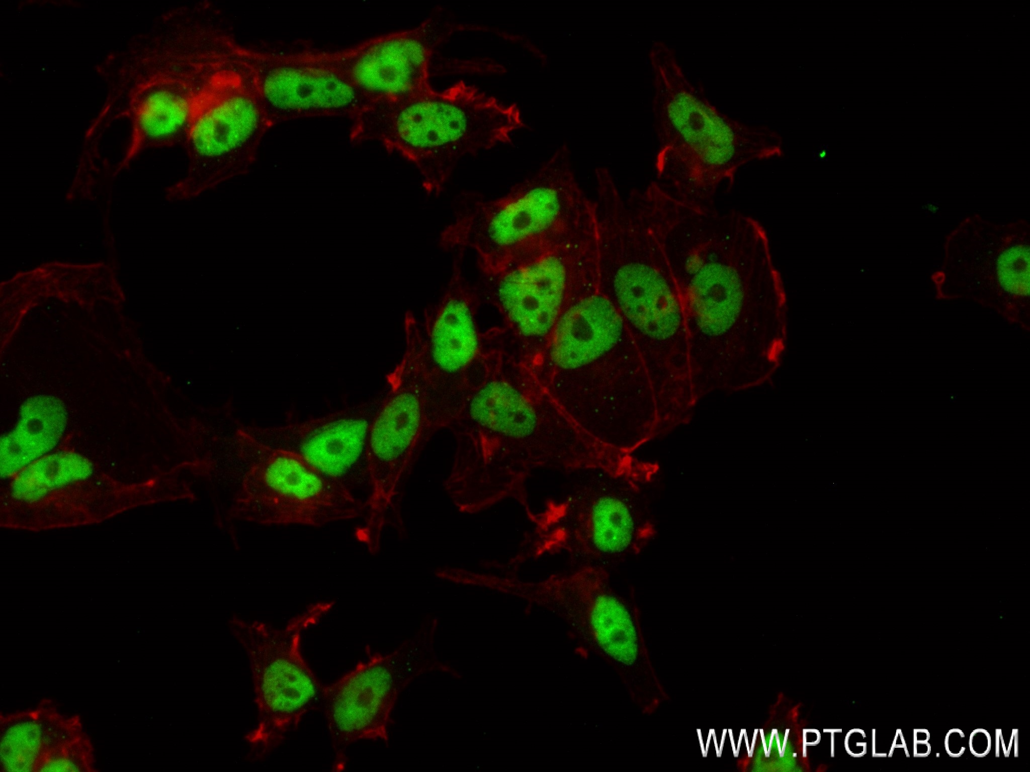 Immunofluorescence (IF) / fluorescent staining of MCF-7 cells using FIP1L1 Recombinant antibody (83863-3-RR)